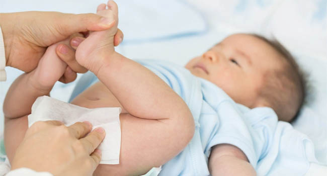 Hẹp bao quy đầu sinh lý hay gặp ở hầu hết bé trai sơ sinh
