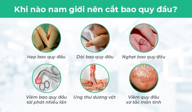 Nam giới nên cắt bao quy đầu khi bị hẹp hoặc dài bao quy đầu, viêm bao quy đầu,...