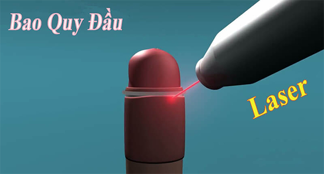 Phương pháp này có ưu điểm là ít chảy máu, giảm thiểu đau đớn sau phẫu thuật