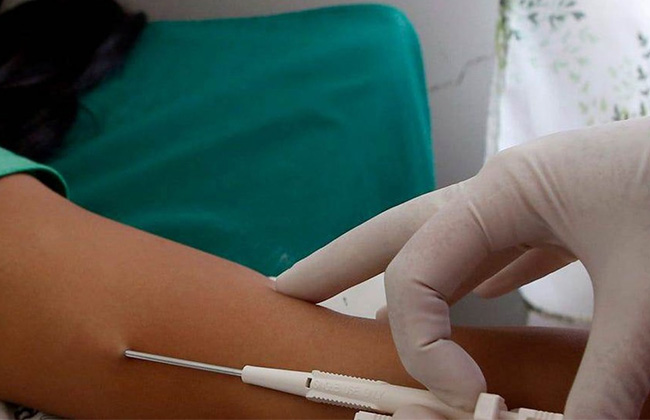Cấy que tránh thai là một phương pháp hiệu quả trong việc ngừa thai