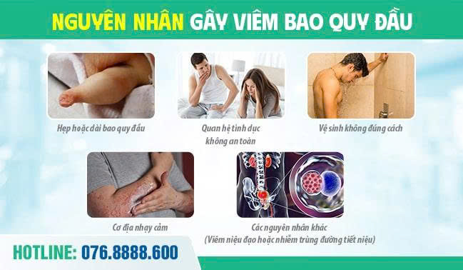 Một số nguyên nhân phổ biến dẫn đến tình trạng viêm bao quy đầu