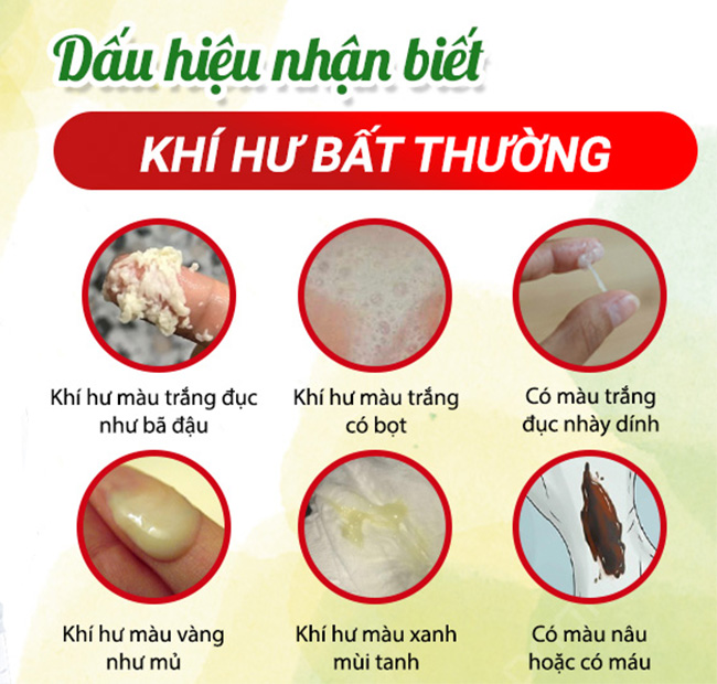 Dấu hiệu khí hư bất thường ở nữ giới