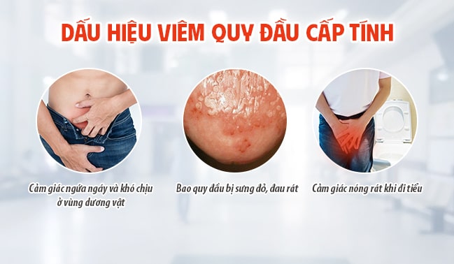 Nam giới bị viêm bao quy đầu cấp tính có cảm giác ngứa ngáy và khó chịu ở vùng dương vật, bao quy đầu bị sưng đỏ