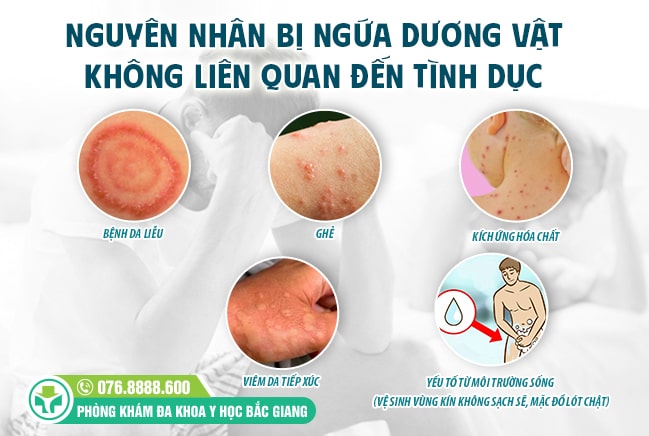 Những nguyên do bị ngứa dương vật không liên quan tới tình dục