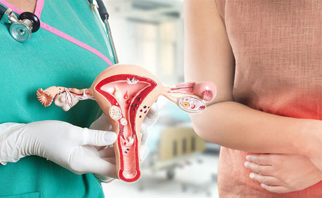 Cần thăm khám sớm khi nghi ngờ có dấu hiệu viêm lộ tuyến cổ tử cung