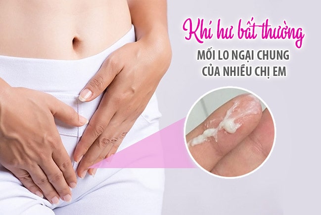 Khí hư bất thường cảnh báo các bệnh lý phụ khoa