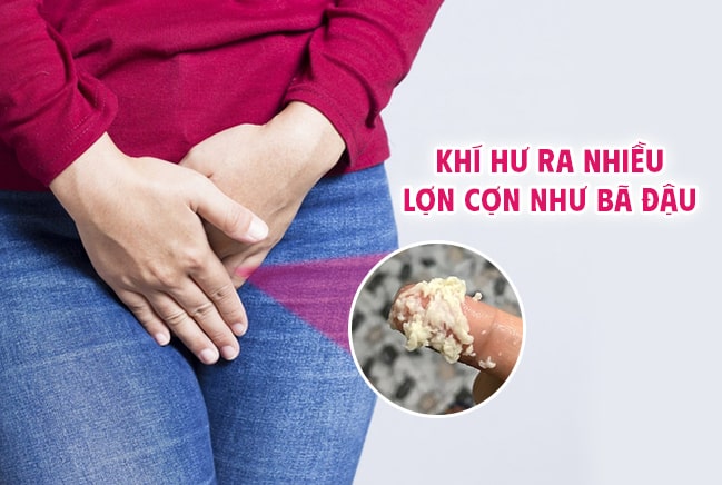 viêm nấm Candida là nguyên nhân gây ra khí hư bã đậu