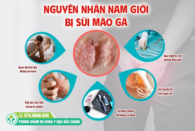 Các nguyên nhân khiến nam giới bị sùi mào gà
