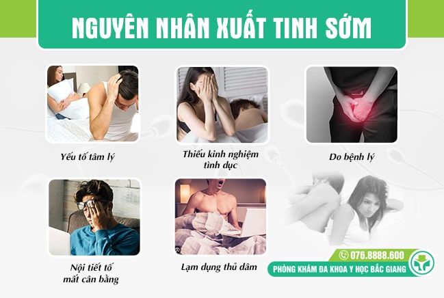 Những nguyên nhân xuất tinh sớm ở nam giới