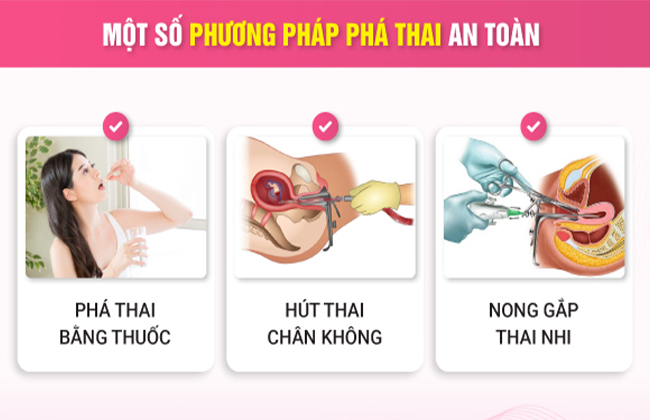 Các phương pháp đình chỉ thai an toàn