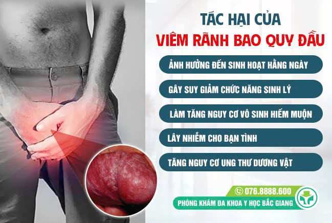 Viêm rãnh bao quy đầu nếu không điều trị kịp thời sẽ gây nhiều biến chứng nguy hiểm