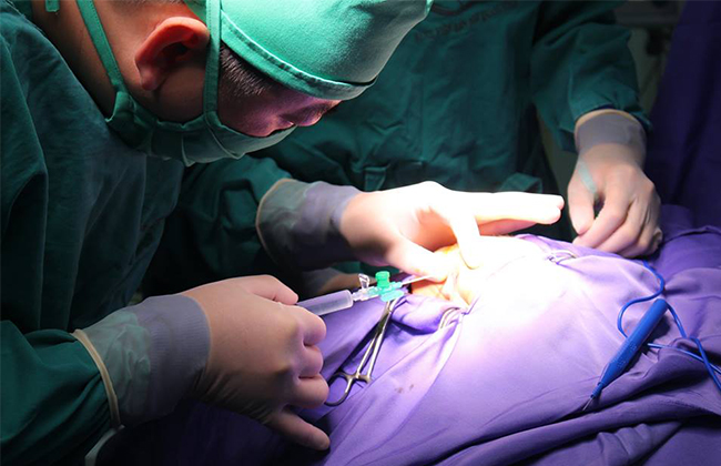Phẫu thuật cắt đường rò (fistulotomy)
