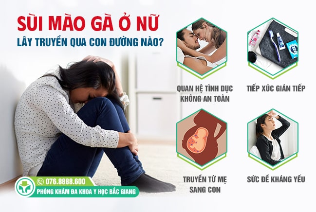 Có 4 con đường lây truyền sùi mào gà ở nữ