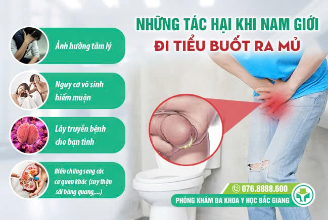 Các biến chứng khi nam giới điêu tiểu buốt có mủ