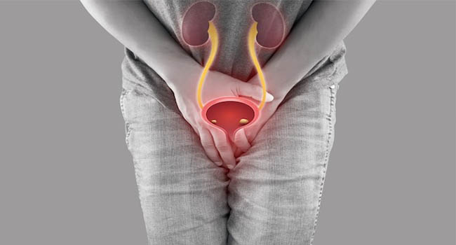 Nam giới đi tiểu buốt có mủ có thể là biểu hiện của bệnh viêm bàng quang